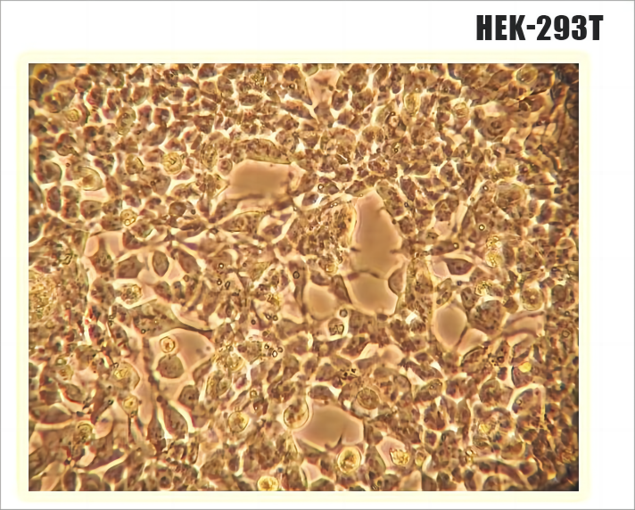 在<i style='color:red'>hek293</i>細(xì)胞系中表達(dá)蛋白的方法步驟和經(jīng)驗(yàn)分享