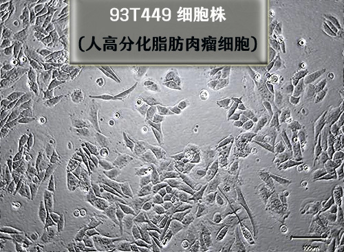 人高分化脂肪肉瘤細胞