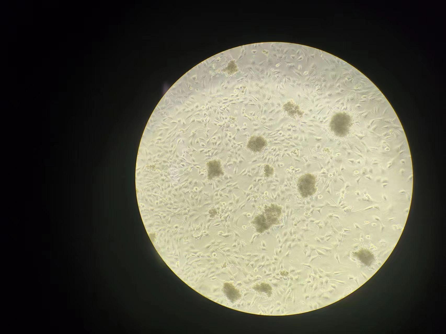 minigene 構(gòu)建時(shí),成纖維細(xì)胞和角質(zhì)形成細(xì)胞培養(yǎng)條件有哪些不同？